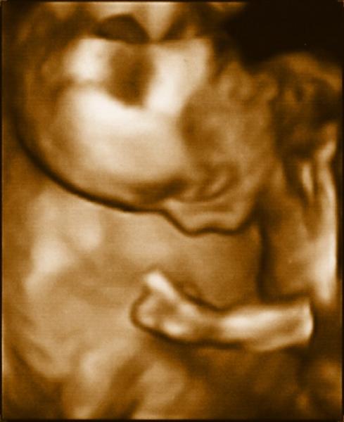 Latest image from Baby Scans